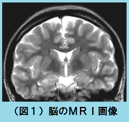 MRI